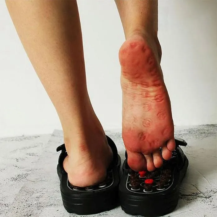 Big Discount! Reflexology and Foot Massage Sandals - Unisex Sizing